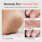 🔥OFFRE ÉCLATANTE🔥 Stick hydratant au gel de pétrole – Squalane et acide hyaluronique, application sans les mains – Pour les mains, les pieds et les talons secs – Pêche ou orange – 35 g ! 🧴✨
